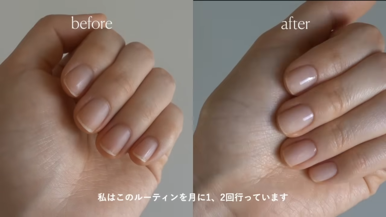 Nail Care and Surrounding Skin Health, Tips for Appearance Charming