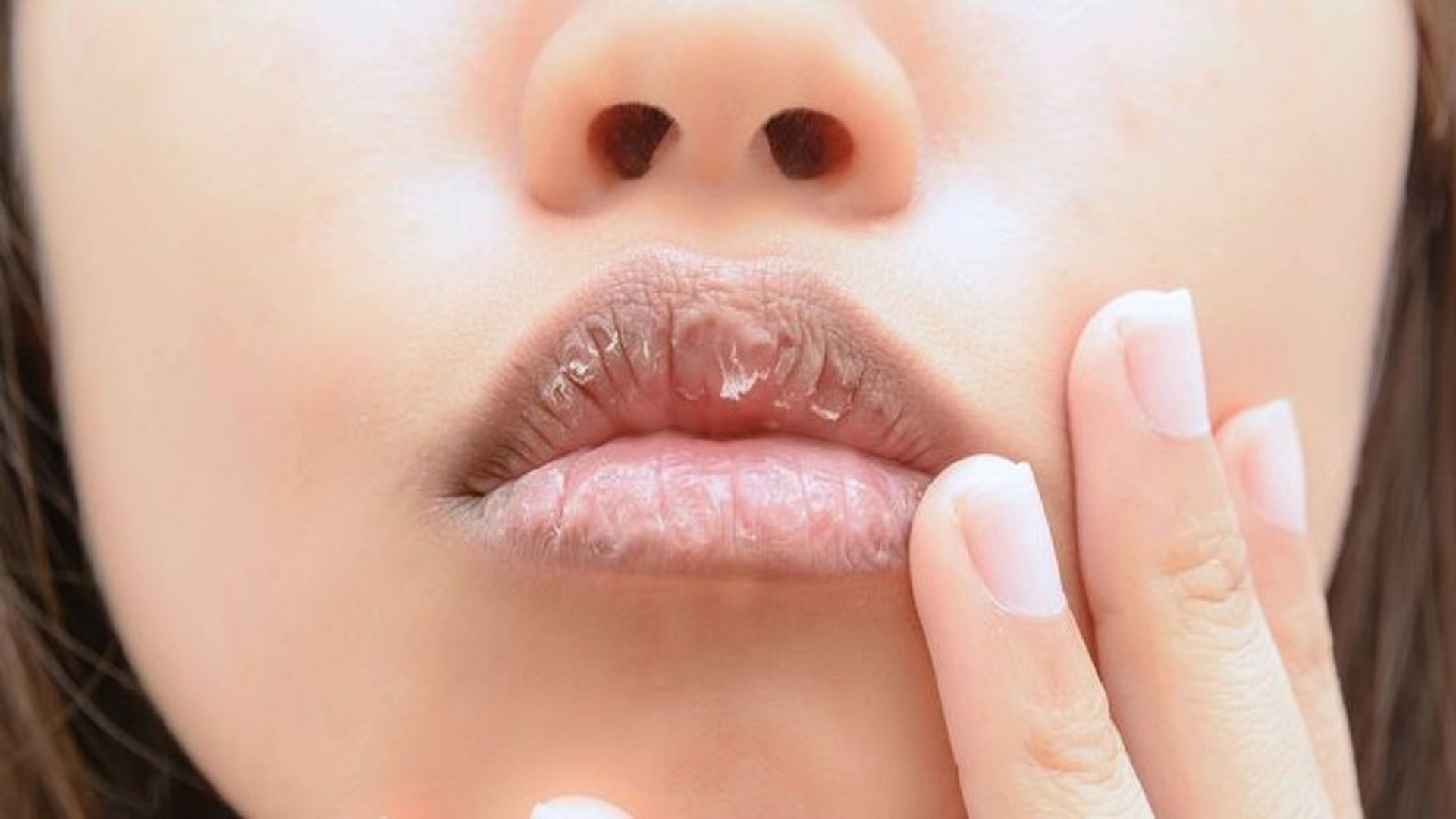 Why Do Lips Itch and How to Treat It Effectively