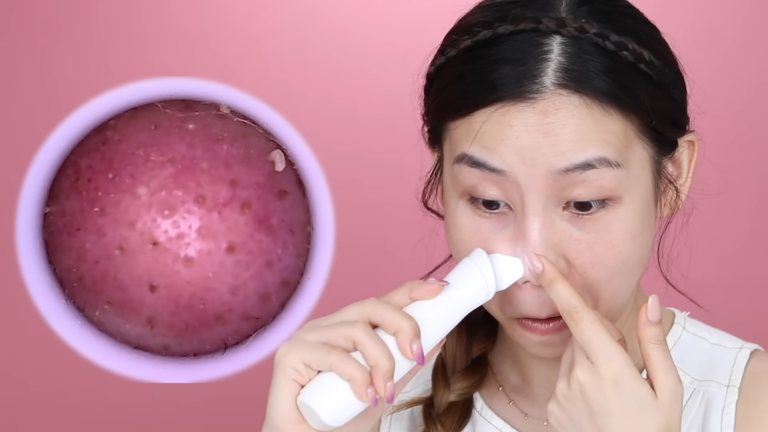 Electric Pore Cleansers, Say Goodbye to Blackheads and Clogged Pores