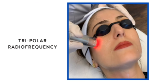 Radiofrequency Skin Care, How to Improve Skin Elasticity