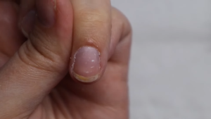 Tips to Avoid Peeling Nails, Proper Care Methods and Recommended Products