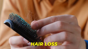 Understanding Hair Loss in Women, Causes and Treatment Options